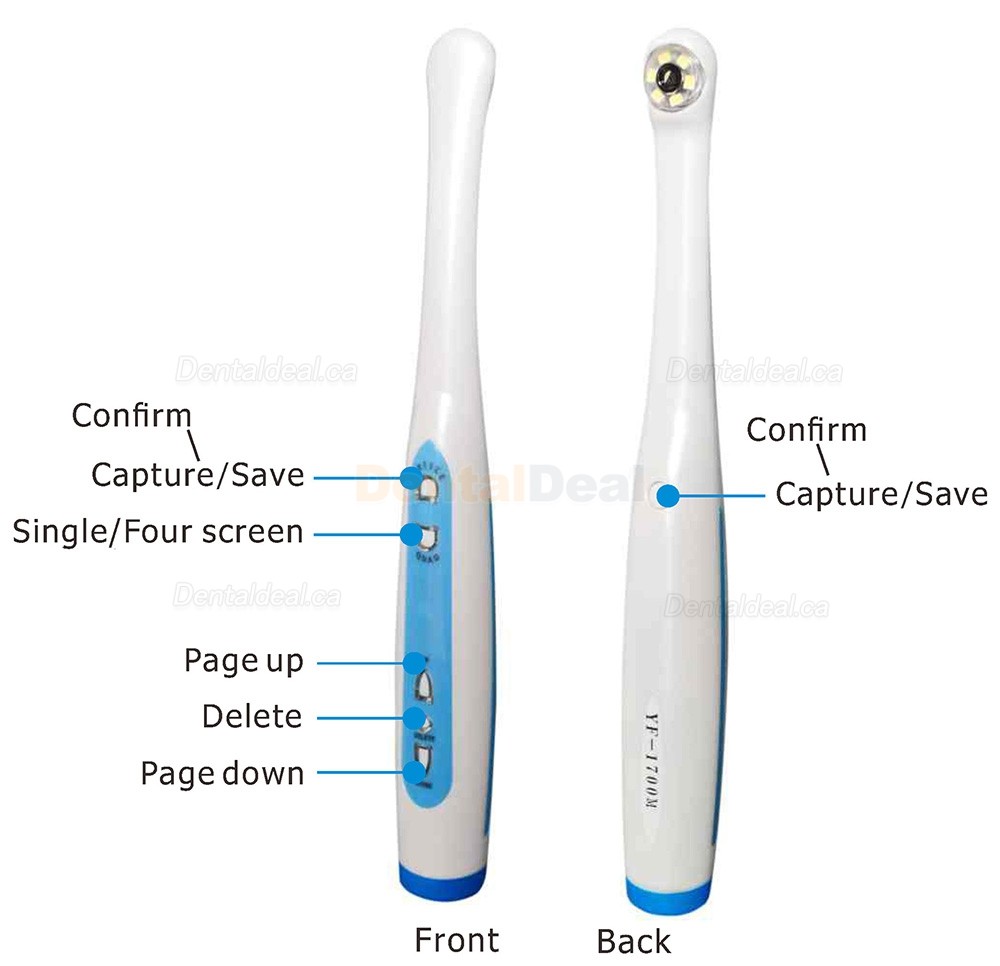 Magenta YF1700M Intraoral Camera with 17 Inch Screen & WIFI